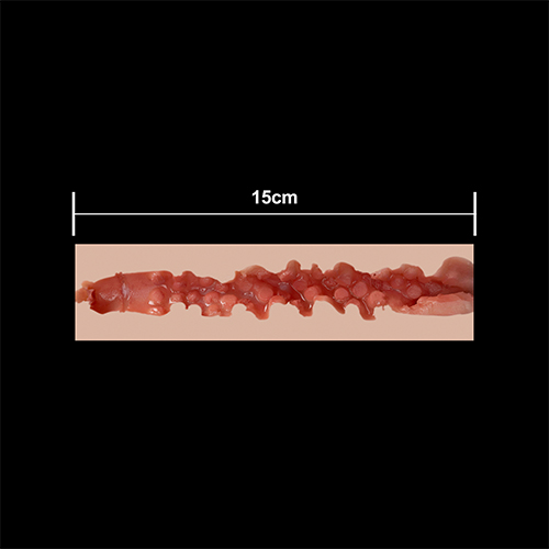 15cm